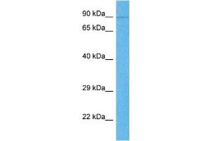 Western Blotting (WB) image for anti-Rhomboid 5 Homolog 1 (RHBDF1) (N-Term) antibody (ABIN2783869)