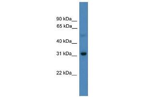 WB Suggested Anti-LBX1  Antibody Titration: 0. (Lbx1 antibody  (N-Term))