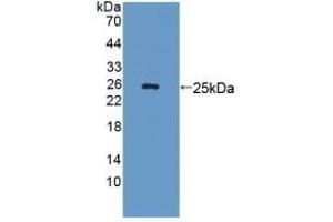 Detection of Recombinant LAMb3, Mouse using Polyclonal Antibody to Laminin Beta 3 (LAMb3) (Laminin beta 3 antibody  (AA 367-568))