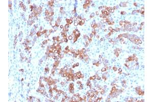 TIM3 antibody  (AA 22-202)