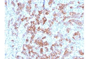 Formalin-fixed, paraffin-embedded human Adrenal stained with TIM3 Mouse Monoclonal Antibody (TIM3/3113). (TIM3 antibody  (AA 22-202))