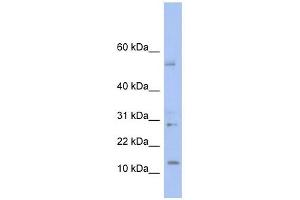 TD1 antibody used at 1 ug/ml to detect target protein. (TLX1 Neighbor antibody  (Middle Region))