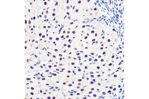 Immunohistochemistry of paraffin-embedded rat ovary using Phospho-IκBα-S36 Rabbit mAb (ABIN7268992) at dilution of 1:100 (40x lens). (NFKBIA antibody  (pSer36))