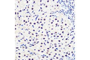 Immunohistochemistry of paraffin-embedded rat ovary using Phospho-IκBα-S36 Rabbit mAb (ABIN7268992) at dilution of 1:100 (40x lens). (NFKBIA antibody  (pSer36))