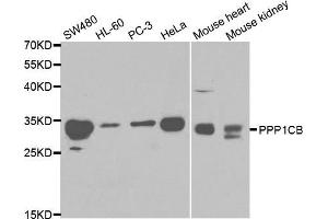 Western blot analysis of extracts of various cell lines, using PPP1CB antibody (ABIN5970446) at 1/1000 dilution.