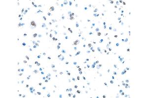 Immunocytochemistry (ICC) image for anti-Poly (ADP-Ribose) Polymerase 1 (PARP1) (AA 750-800) antibody (ABIN7449531) (Recombinant PARP1 antibody  (AA 750-800))