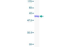 ECHS1 Protein (AA 13-290) (GST tag)