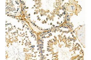 anti-Diacylglycerol Kinase, eta (DGKH) (Internal Region) antibody