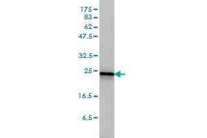 RRAS2 monoclonal antibody (M01A), clone 2D3-4B8 Western Blot analysis of RRAS2 expression in A-431 . (RRAS2 antibody  (AA 1-204))