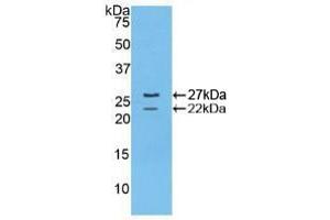 Detection of Recombinant FBN1, Mouse using Polyclonal Antibody to Fibrillin 1 (FBN1) (Fibrillin 1 antibody  (AA 1703-1889))