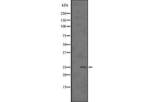 Western blot analysis GSC2 using HUVEC whole cell lysates (GSC2 antibody  (Internal Region))