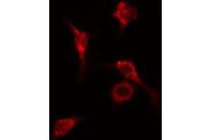 ABIN6278632 staining Hela cells by IF/ICC. (RPL14 antibody  (Internal Region))