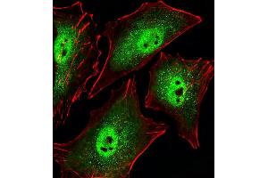 Fluorescent image of A549 cells stained with Mouse Sirt1 Antibody (C-term) (ABIN6242824 and ABIN6577619). (SIRT1 antibody  (C-Term))