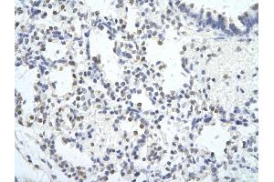 Rabbit Anti-MED6 Antibody        Paraffin Embedded Tissue:  Human Lung cell   Cellular Data:  Epithelial cells of renal tubule  Antibody Concentration:   4. (MED6 antibody  (C-Term))