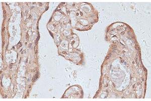 Immunohistochemistry of paraffin-embedded Human placenta using TLK1 Polyclonal Antibody at dilution of 1:100 (40x lens). (TLK1 antibody)