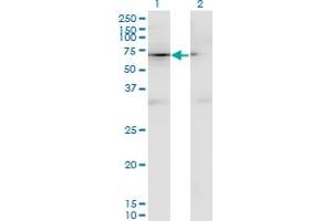 Western Blot analysis of CD44 expression in transfected 293T cell line by CD44 monoclonal antibody (M13), clone 4D2. (CD44 antibody  (AA 1-699))