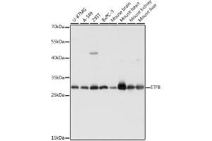Western blot analysis of extracts of various cell lines, using ETFB antibody (ABIN7266916) at 1:1000 dilution.