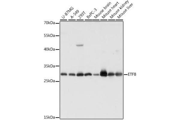 ETFB antibody  (AA 80-230)