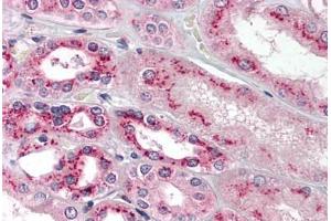 Human Kidney:  (formalin-fixed, paraffin-embedded) stained with TBXAS1 antibody ABIN214195 at 5 ug/ml followed by biotinylated goat anti-rabbit IgG secondary antibody ABIN481713, alkaline phosphatase-streptavidin and chromogen. (TBXAS1 antibody  (AA 359-377))
