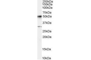 Image no. 1 for anti-Activating Transcription Factor 2 (ATF2) (C-Term) antibody (ABIN374122) (ATF2 antibody  (C-Term))