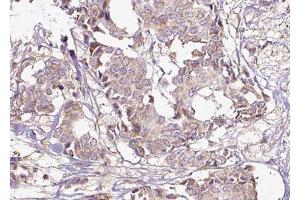 Immunohistochemistry (IHC) image for anti-14-3-3 zeta (YWHAZ) (pSer58) antibody (ABIN6256377)