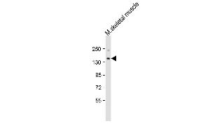 Anti-Jarid2 Antibody (C-term)at 1:2000 dilution + mouse skeletal muscle lysates Lysates/proteins at 20 μg per lane. (JARID2 antibody  (C-Term))