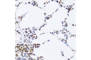 Immunohistochemistry (Paraffin-embedded Sections) (IHC (p)) image for anti-Nuclear Factor of kappa Light Polypeptide Gene Enhancer in B-Cells 2 (NFKB2) (AA 690-899) antibody (ABIN3017388)