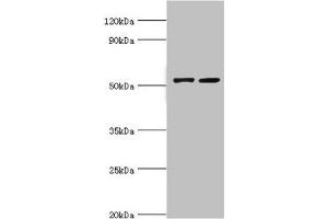 Western blot All lanes: CBLC antibody at 14 μg/mL Lane 1: A549 whole cell lysate Lane 2: Hela whole cell lysate Secondary Goat polyclonal to rabbit IgG at 1/10000 dilution Predicted band size: 53, 48 kDa Observed band size: 53 kDa (CBLC antibody  (AA 245-474))