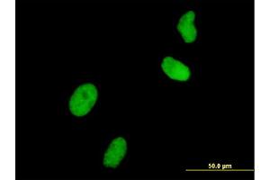 Immunofluorescence (IF) image for anti-Ubiquitin-Like, Containing PHD and RING Finger Domains, 1 (UHRF1) (AA 694-793) antibody (ABIN565416)