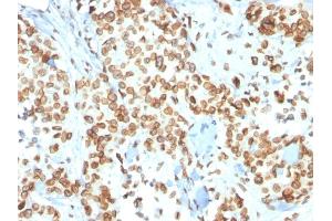 Immunohistochemistry (IHC) image for anti-Emerin (EMD) (AA 56-167) antibody (ABIN6939303)