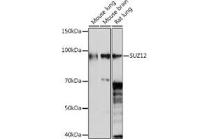 anti-SUZ12 Polycomb Repressive Complex 2 Subunit (SUZ12) antibody