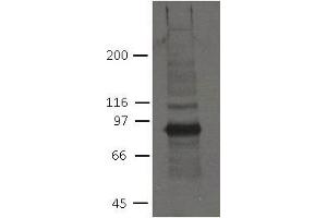 Image no. 1 for anti-Plakophilin 2 (PKP2) (AA 1-350) antibody (ABIN1169700) (Plakophilin 2 antibody  (AA 1-350))