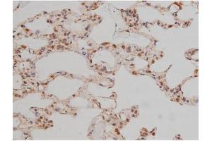 ABIN6267334 at 1/200 staining Rat lung tissue sections by IHC-P. (SP1 antibody  (pThr739))