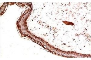 Immunohistochemistry of paraffin-embedded Human skin tissue using PDGFRA Monoclonal Antibody at dilution of 1:200. (PDGFRA antibody)