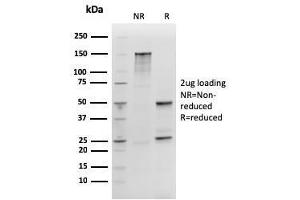 SDS-PAGE Analysis SOX2 Recombinant Mouse Monoclonal Antibody (rSOX2/1792). (Recombinant SOX2 antibody  (AA 176-305))