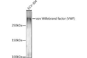 Western blot analysis of extracts of ECV-304 cells, using von Willebrand factor (VWF) antibody (ABIN3015449, ABIN3015450, ABIN5663874 and ABIN6217310) at 1:1000 dilution.