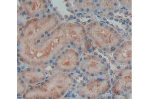 Immunohistochemistry (IHC) image for anti-Optic Atrophy 3 (Autosomal Recessive, with Chorea and Spastic Paraplegia) (OPA3) (AA 1-200) antibody (ABIN5014055)
