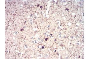 Immunohistochemical analysis of paraffin-embedded brain tissues using CALB2 mouse mAb with DAB staining.
