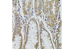 Immunohistochemistry of paraffin-embedded human stomach using PDCD6IP antibody (ABIN1874065) at dilution of 1:100 (40x lens). (ALIX antibody)