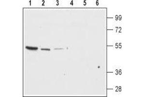 Western blot analysis of rat brain membrane (lanes 1 and 4), mouse brain (lanes 2 and 5) and mouse kidney lysates (lanes 3 and 6): - 1-3. (KCNJ13 antibody  (Extracellular Loop))