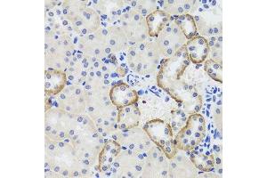 Immunohistochemistry of paraffin-embedded mouse kidney using MTERFD3 antibody. (MTERFD3 antibody  (AA 1-250))