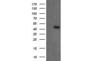 Image no. 1 for anti-Mitogen-Activated Protein Kinase Kinase 2 (MAP2K2) antibody (ABIN1499478) (MEK2 antibody)