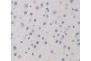 Figure. (IDH1 antibody  (AA 99-325))