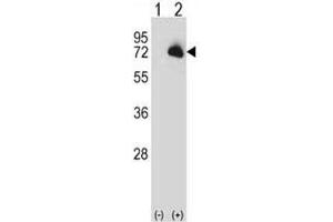 Western blot analysis of BTK antibody and 293 cell lysate (2 ug/lane) either nontransfected (Lane 1) or transiently transfected (2) with the BTK gene. (BTK antibody  (AA 27-55))