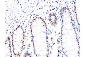 Immunohistochemistry of paraffin-embedded human colon using DKC1 Rabbit mAb (ABIN7266869) at dilution of 1:100 (40x lens). (DKC1 antibody)