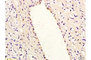 Formalin-fixed and paraffin embedded rabbit carotid artery labeled with Anti-IL-8/CXCL8 Polyclonal Antibody, Unconjugated (ABIN728053) at 1:200, followed by conjugation to the secondary antibody and DAB staining