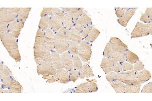 Detection of TNNI2 in Mouse Skeletal muscle Tissue using Polyclonal Antibody to Troponin I Type 2, Fast Skeletal (TNNI2) (TNNI2 antibody  (AA 1-182))