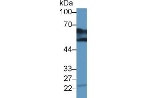 Detection of DDC in Bovine Kidney lysate using Polyclonal Antibody to Dopa Decarboxylase (DDC) (DDC antibody  (AA 200-420))