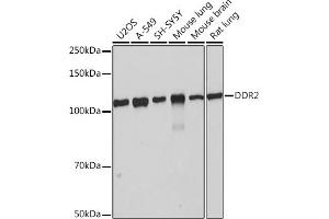 Western blot analysis of extracts of various cell lines, using DDR2 Rabbit mAb (ABIN7266790) at 1:1000 dilution. (DDR2 antibody)