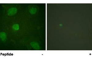 Immunofluorescence analysis of HeLa cells, treated with TNF-a (20 nM, 15 mins), using TGFB1I1 polyclonal antibody .